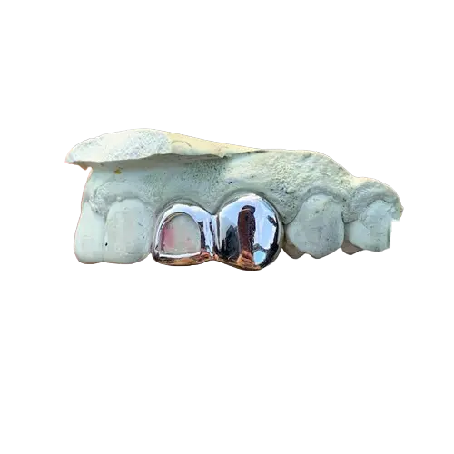 2 Teeth Grillz with 1 Open Face