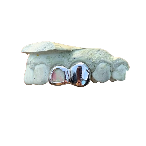 2 Teeth Grillz with 1 Open Face